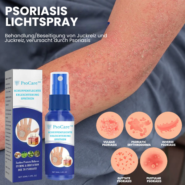 Psoriasis Relief spray