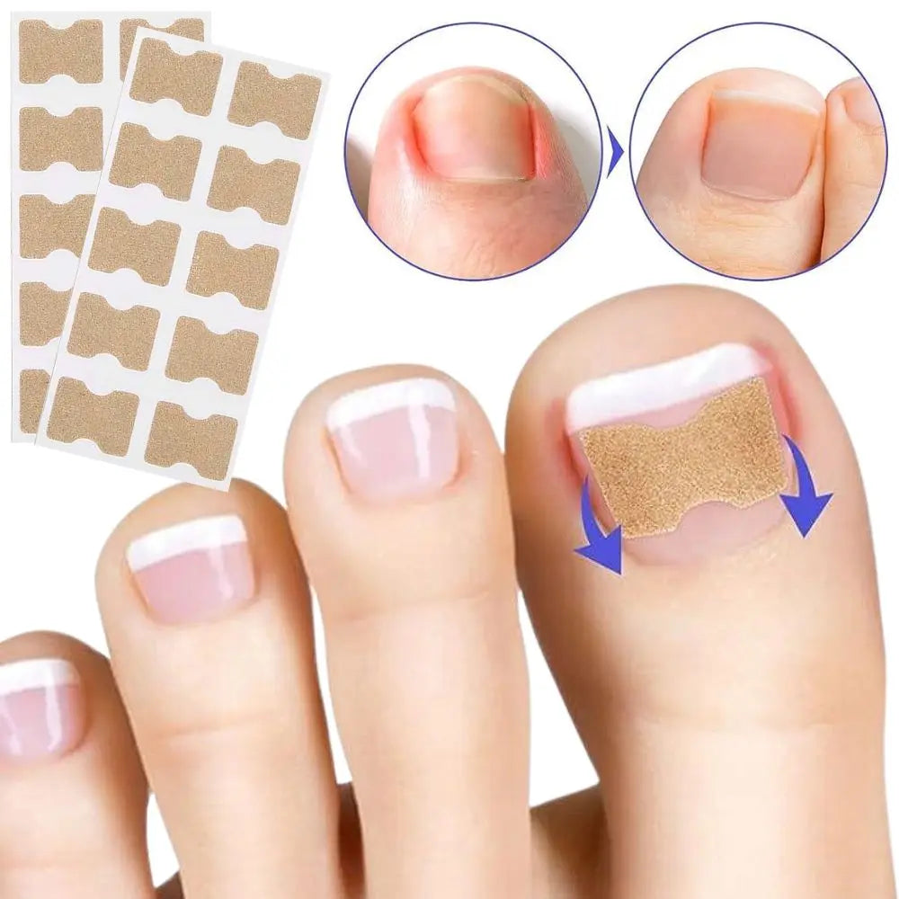 NailRevive™ Nail Correction Patches