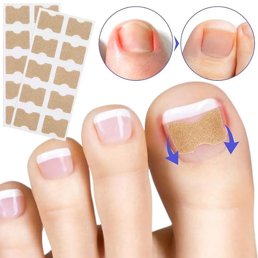 NailRevive™ Nail Correction Patches