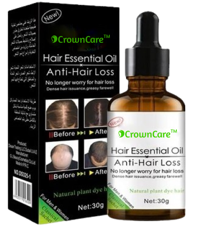 CrownCare™ | Hair Regrowth Oil Serum for Men and Women